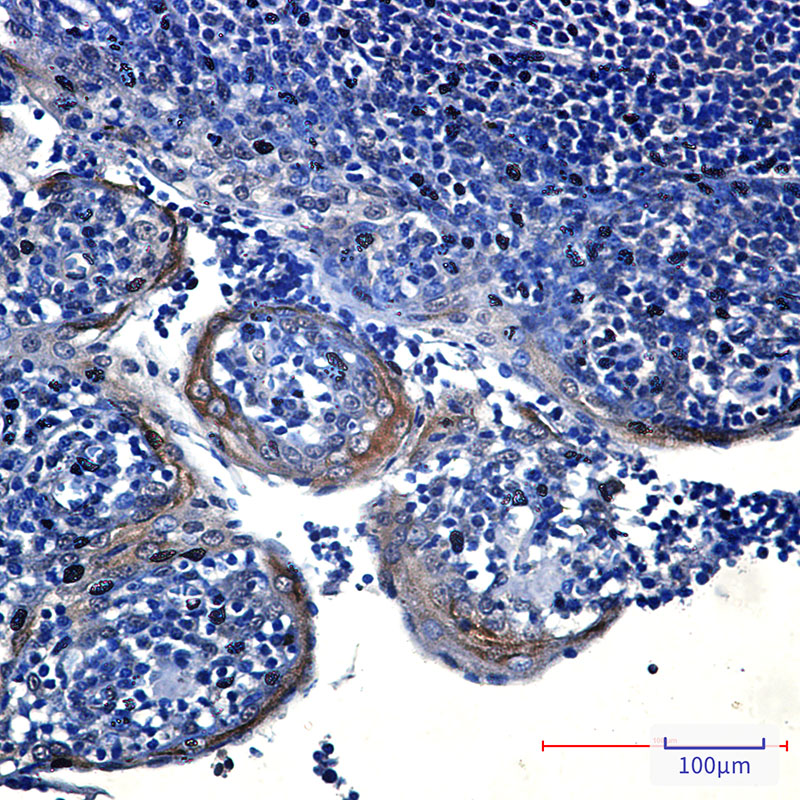 eIF4A3 Rabbit mAb